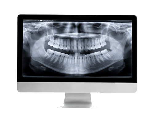 Digital X-Rays