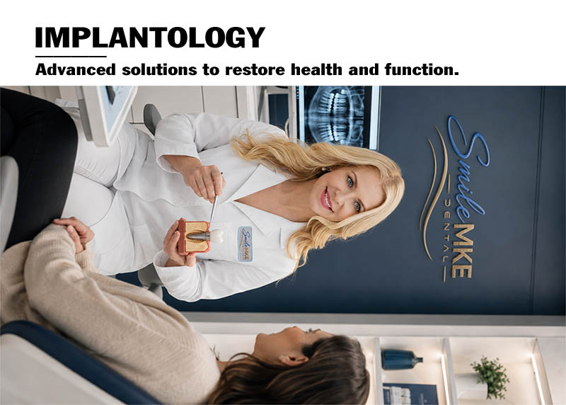 downtown Milwaukee Dental Implants